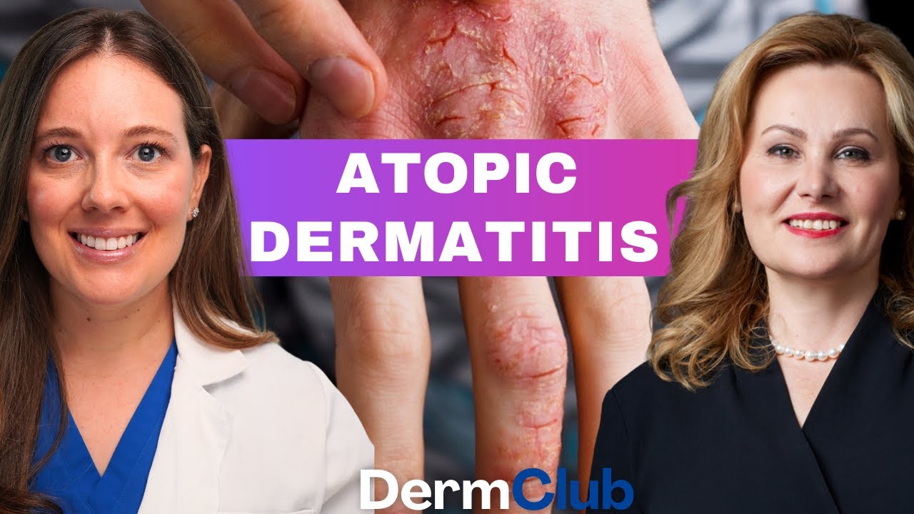 Treating Atopic Dermatitis | Expert Dermatology Advice