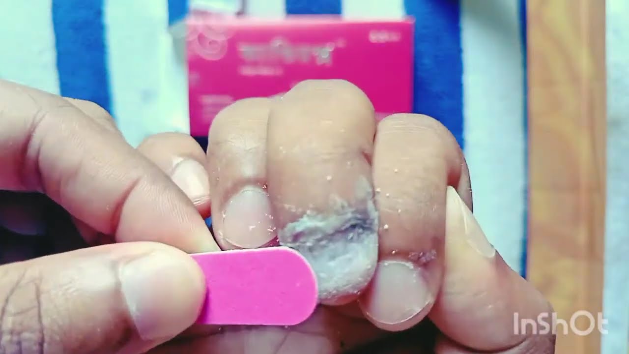 Day 3 | Candirox Nail Lacquer #nails