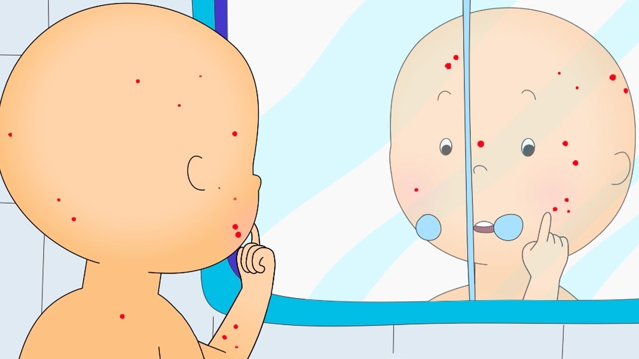 Caillou en Español Castellano | Caillou con Varicela | Dibujos Animados Capítulos Completos