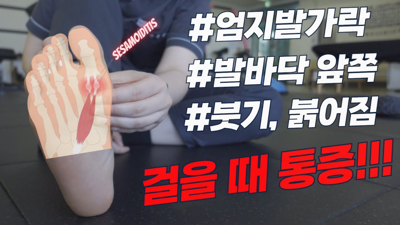 매일 5분!!! 엄지발가락, 발바닥 앞 쪽 통증 없이 편하게 걸으세요 (종자골염, 중족골통, 지간신경종)(Top 4 Sesamoiditis Stretches & Exercises)