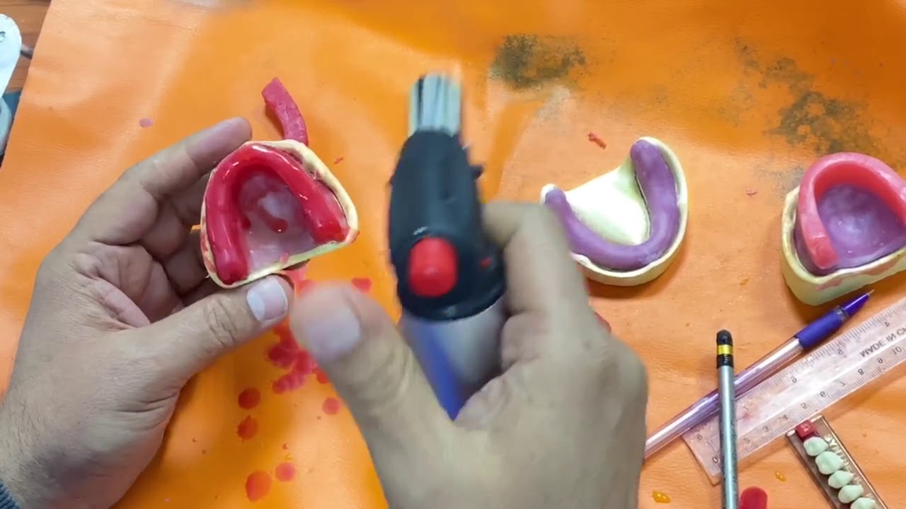 كيفية تثبيت الbite rim على الريكورد بيس / الجزء الثاني.