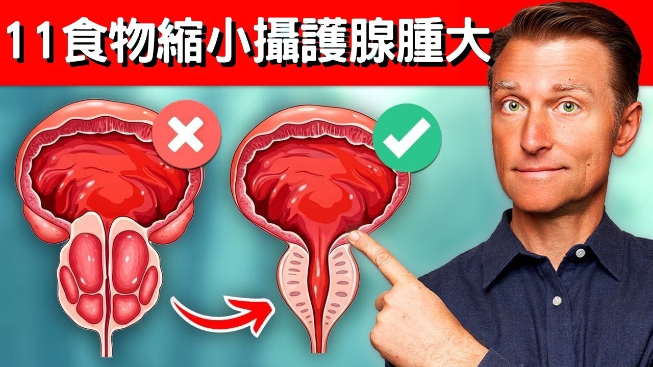 11種縮小攝護腺腫大的食物 柏格醫生 Dr Berg