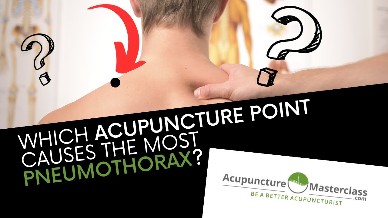 Acupuncture and Pneumothorax - Which Point is the Problem?
