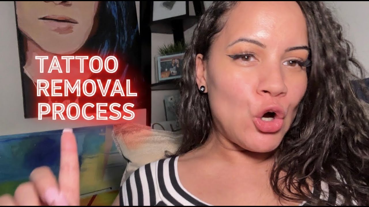TATTOO REMOVAL PROCESS 2026 | Here’s a day in the life of what happened 
