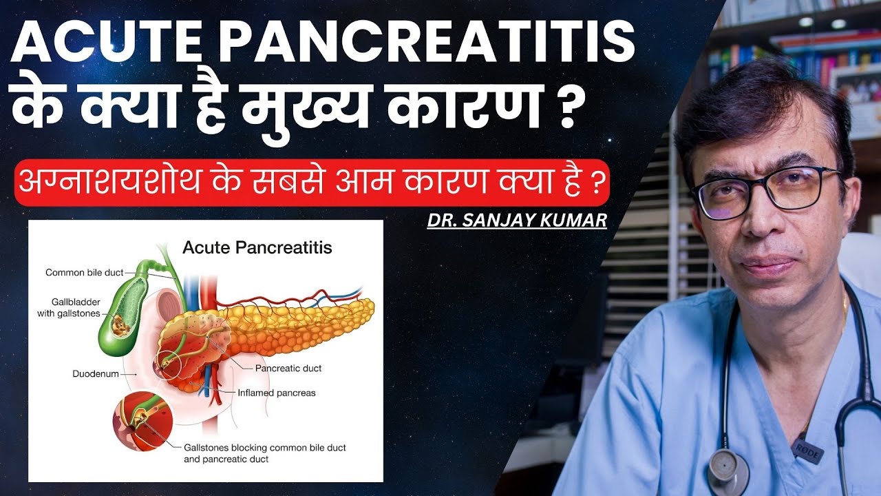 Acute Pancreatitis के क्या है मुख्य कारण ? | अग्नाशयशोथ के  सबसे आम कारण क्या है ?