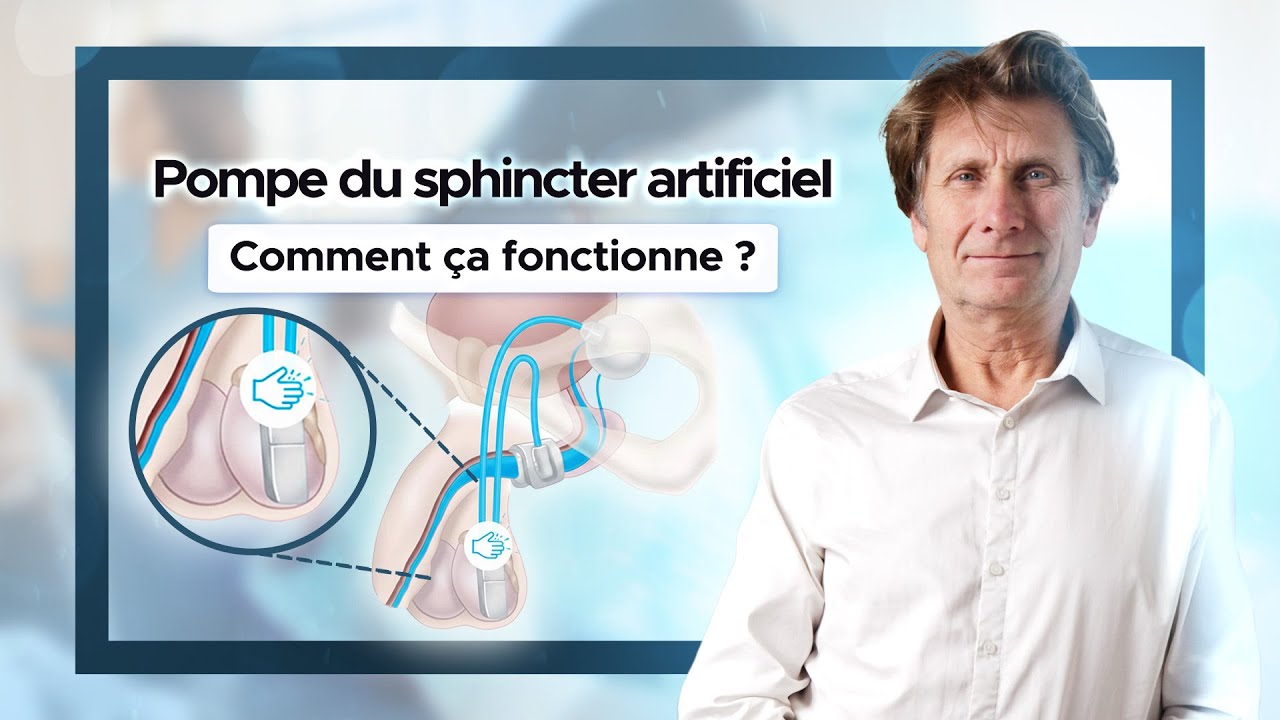 Sphincter urinaire artificiel : bien utiliser la pompe | Explications du Pr François Haab, urologue