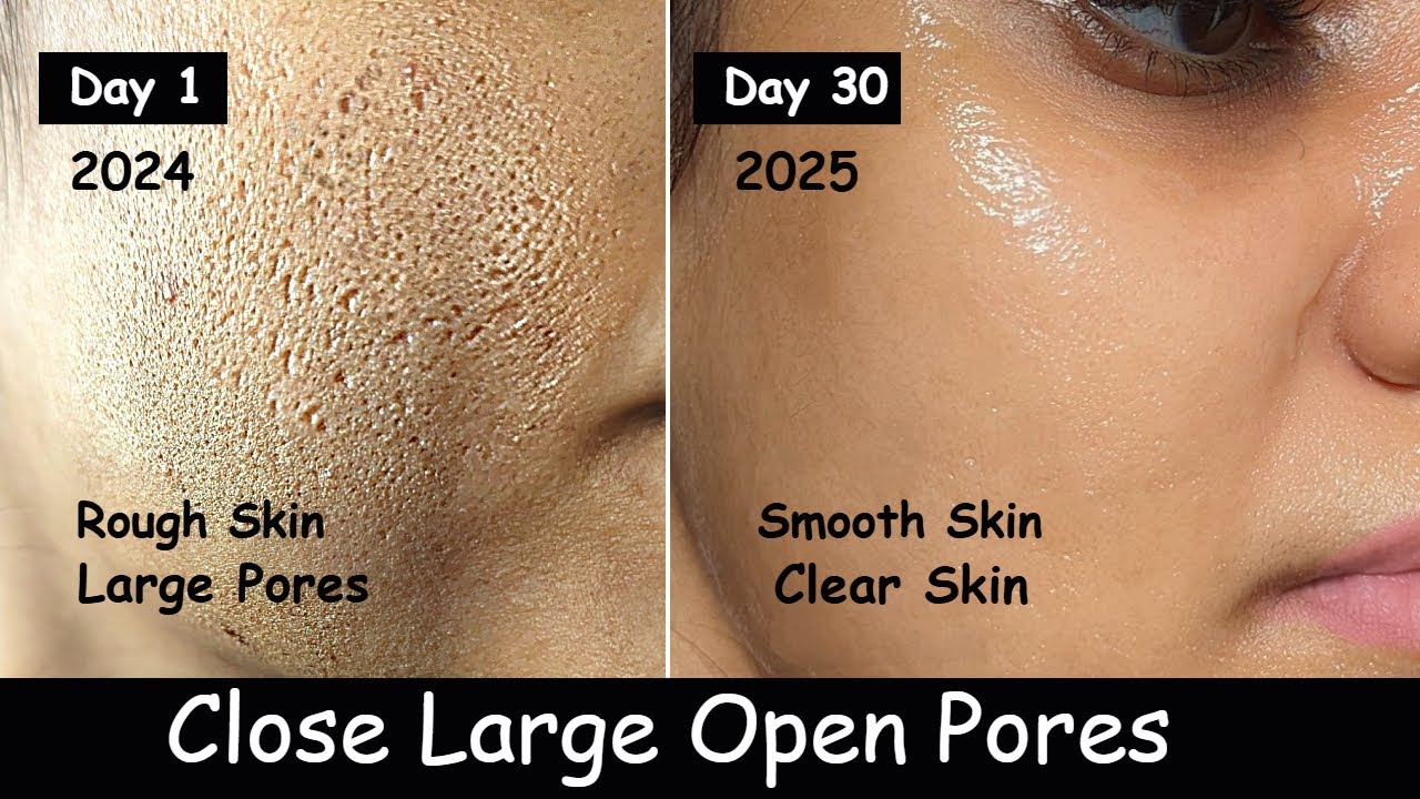 Damaged Skin Repair - Close Large OPEN PORES | Dark Spots & Skin Whitening | Aloevera Ice cubes