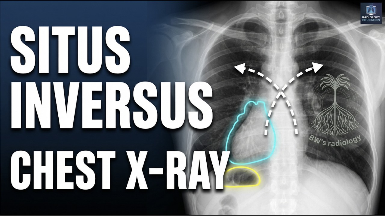 Chest - Situs inversus