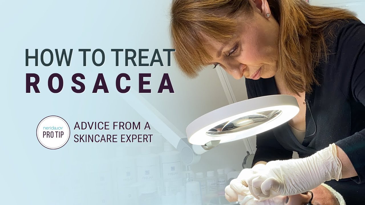 How to Treat Rosacea - Advice from a Skincare Expert