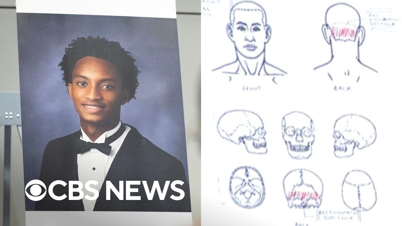 New questions emerge in Nolan Wells' death after family's independent autopsy