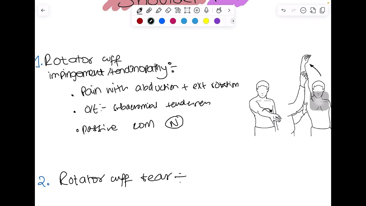 Shoulder Pain Explained | USMLE Step 2