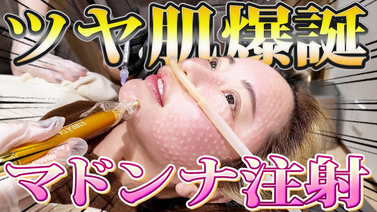 【新・赤み治療】アドバテックス×肌育マドンナ注射でツヤ爆誕❤️‍🩹