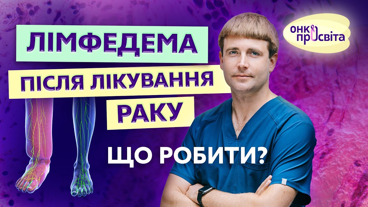 Лімфедема після лікування раку. Що робити?