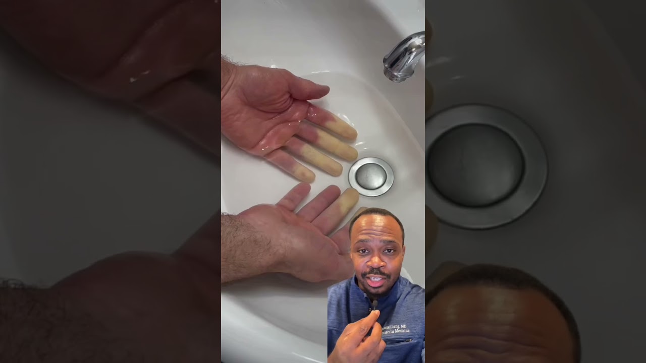 Che fine hanno fatto le sue MANI?! Reazione #shorts #ytshorts