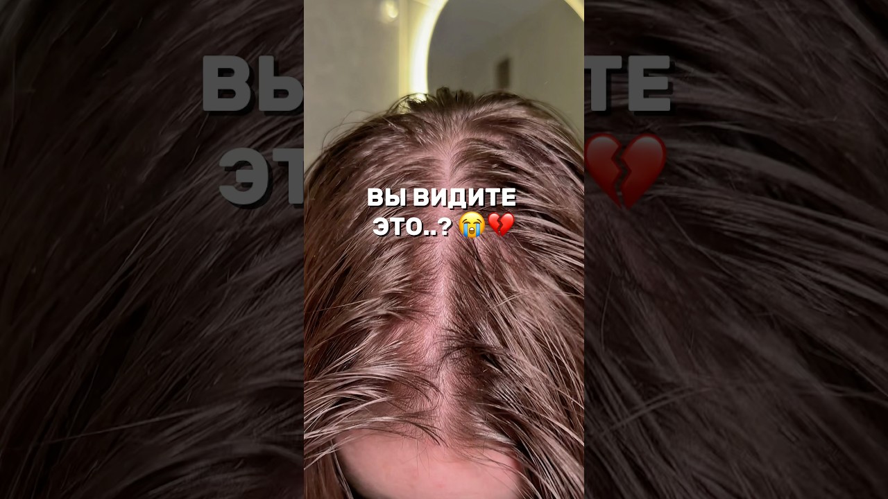 Жирнится и Шелушится кожа головы?💔 #WW326406 - арт. на пилинг-скраб (вводи с WW)❗️РП #пилинг #уход