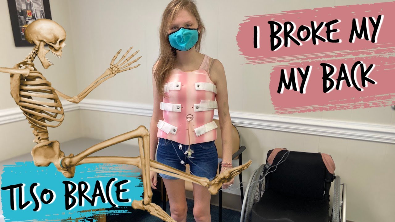 Osteoporosis Sucks!! | TLSO Brace Fitting