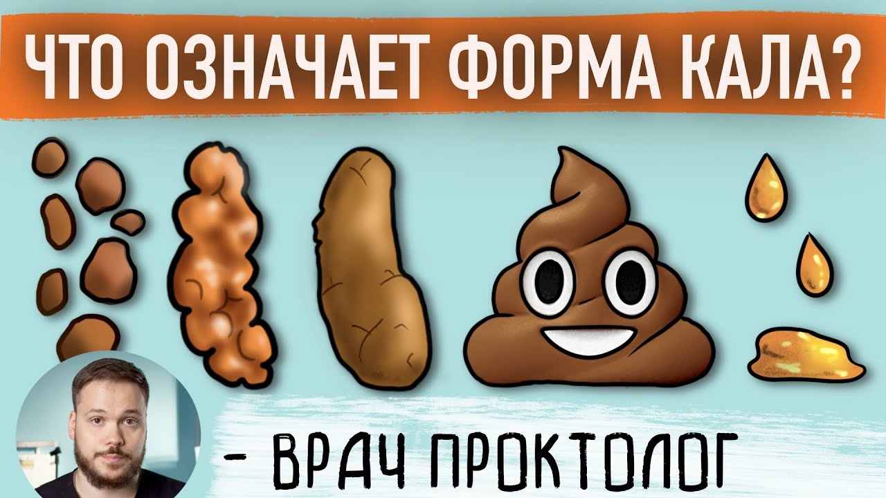 О ЧЕМ ГОВОРИТ ФОРМА СТУЛА. Бристольская шкала кала.