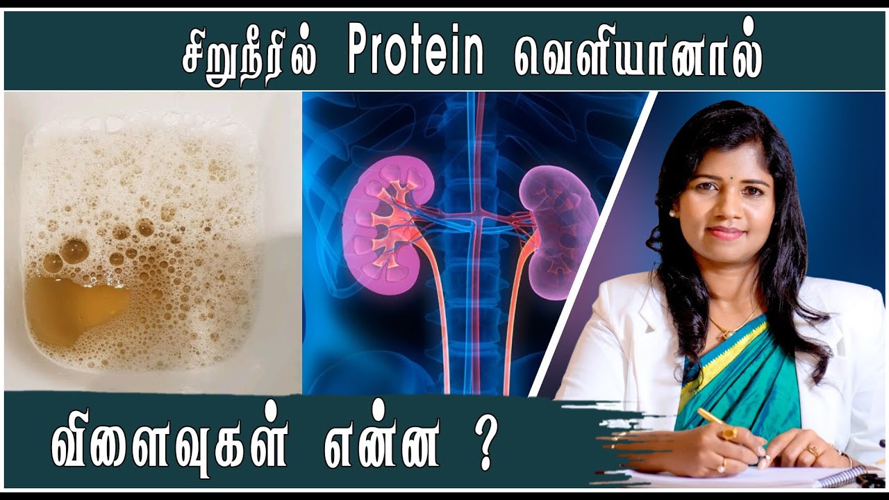 சிறுநீரில் புரோட்டின் வெளியாவதை குணப்படுத்துவது எப்படி ? | Dr. B.Yoga Vidhya