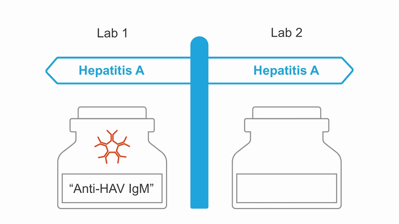 Important lab markers in HAV infection.