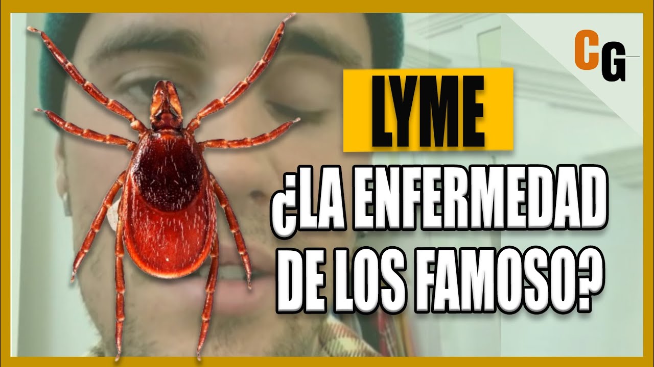 Enfermedad de Lyme - &iquest;La Enfermedad de los Famosos? - Fisiopatolog&iacute;a, S&iacute;ntomas y Controversia