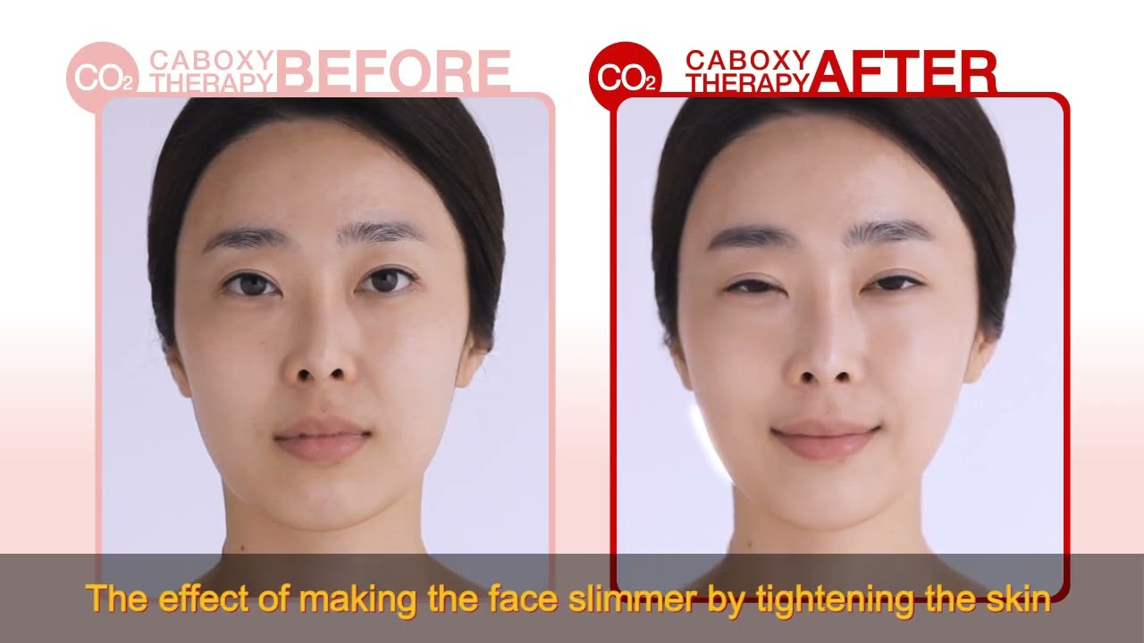 How to use  _ Carboxy Therapy Mask Pack from Korea
