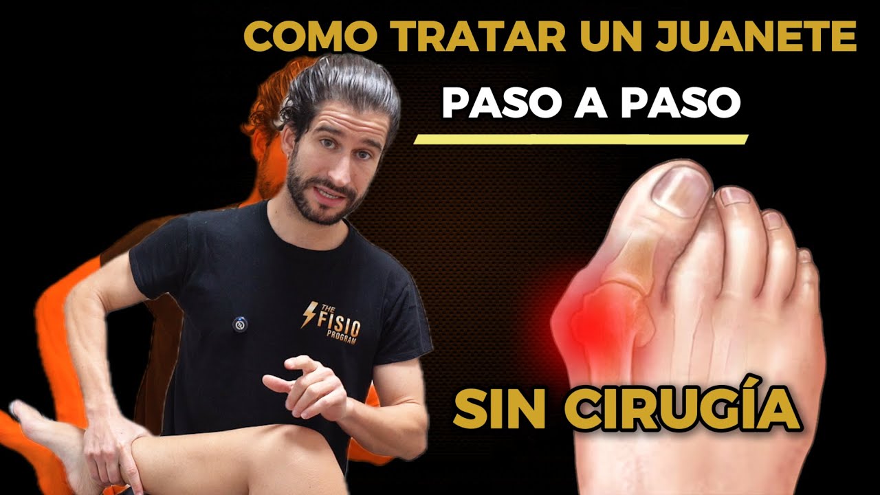 Caso clínico real: cómo un juanete puede provocar dolor de cadera | Fisioterapia. Parte 1