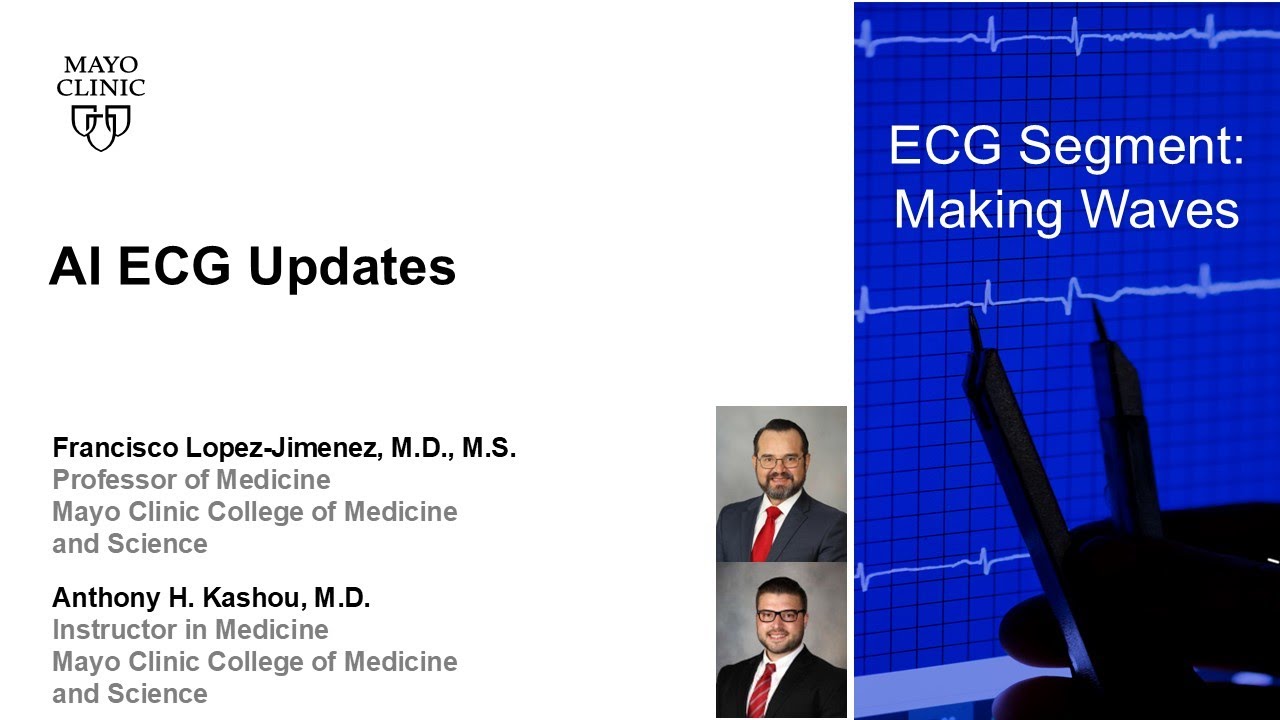 AI ECG Updates