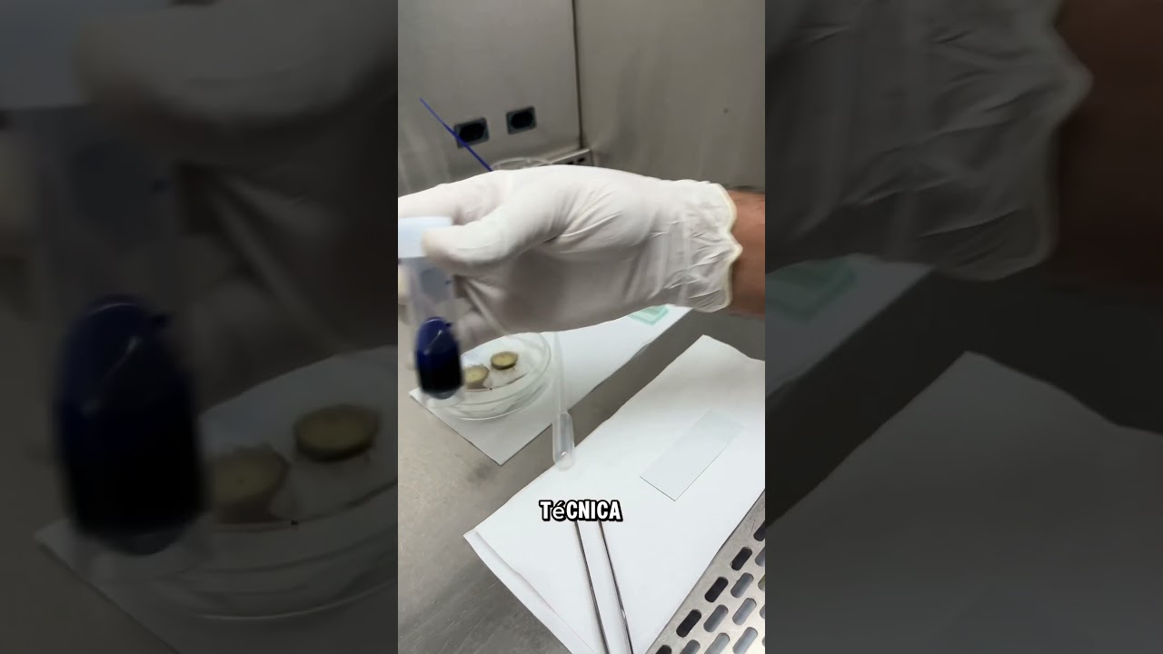 Fungos em l&acirc;mina no microsc&oacute;pio #micologia