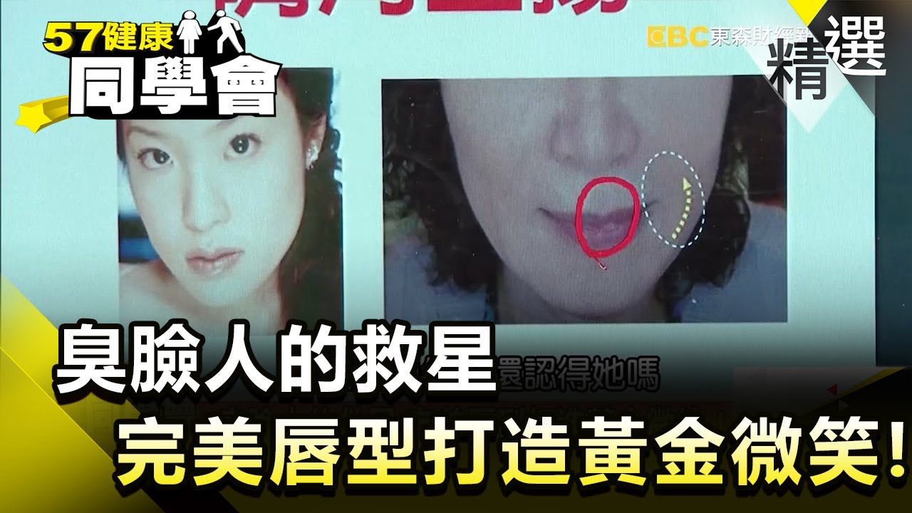 臭臉人的救星 完美唇型打造黃金微笑！【健康同學會】精華篇｜隋安德 許晶晶
