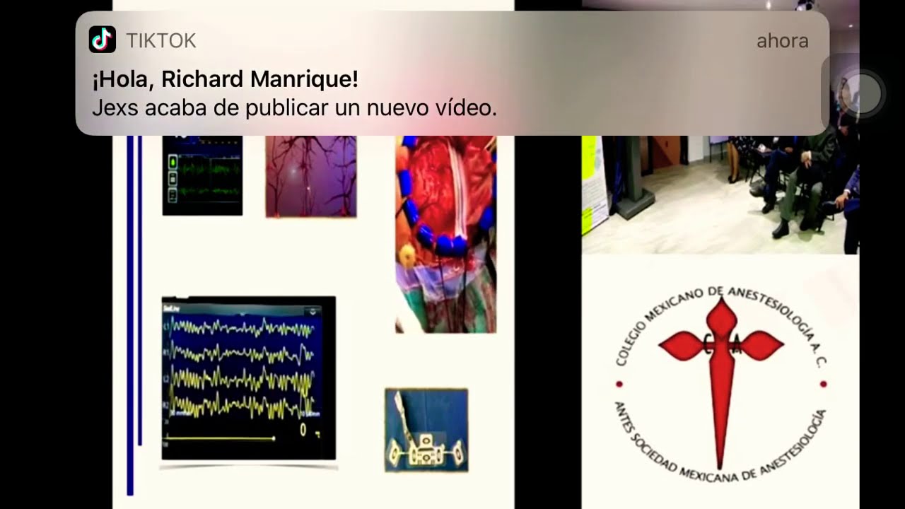 Neuro Monitoreo con Sedline