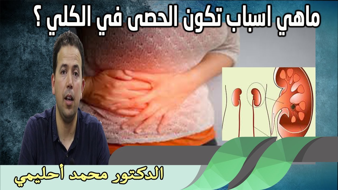 ماهي اسباب تكون الحصى في الكلي ؟ الدكتور محمد احليمي