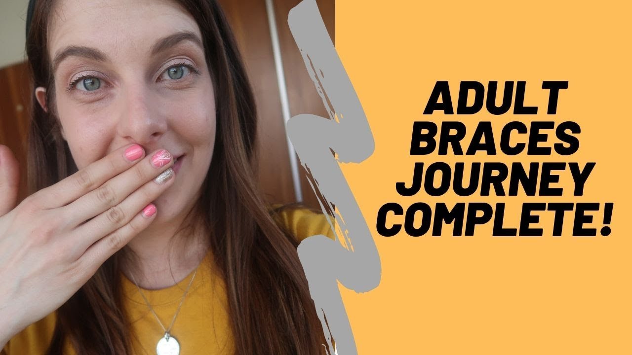 Adult Braces Journey Finally Finished After 2 and a Half Years.