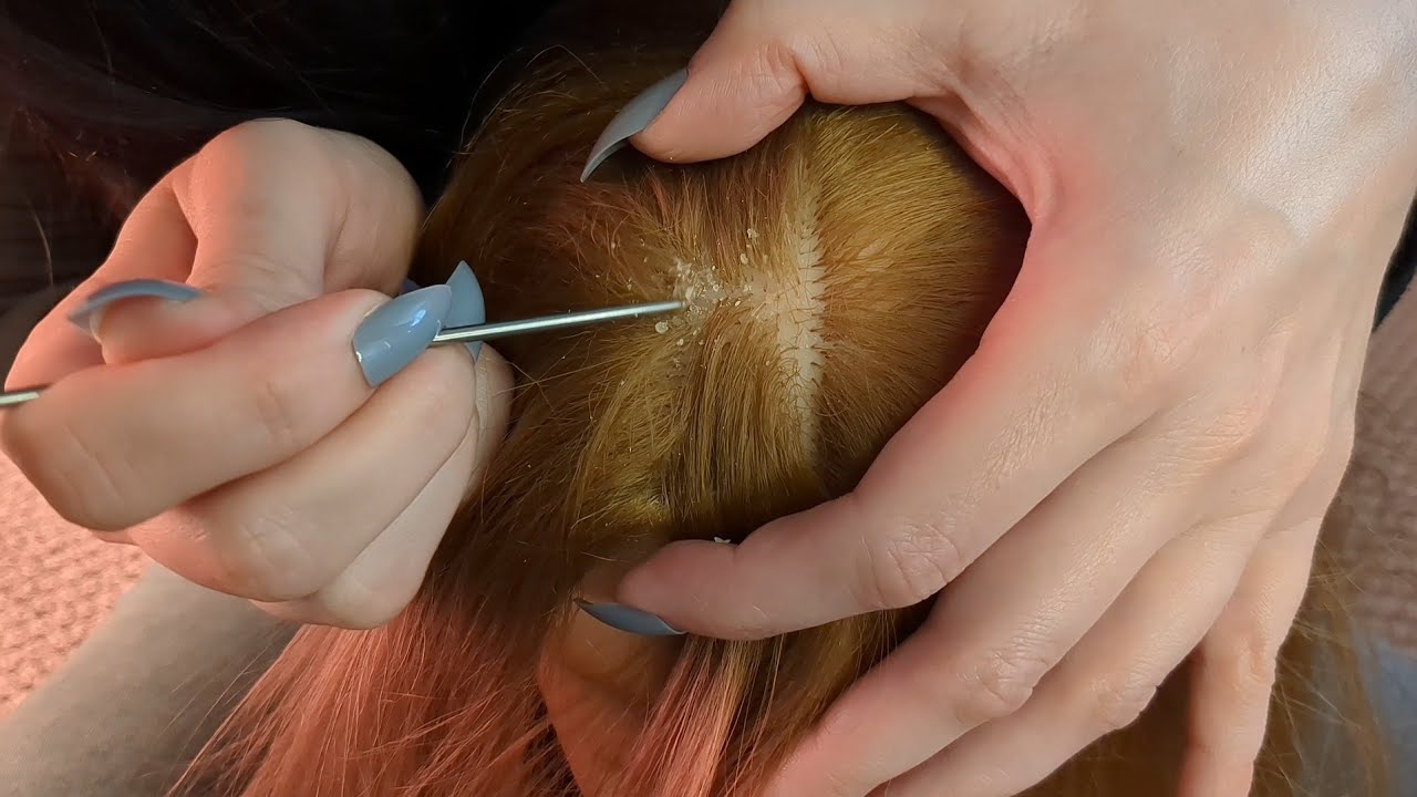 ASMR Satisfying Scalp Check for Dandruff 💆‍♀️( no talking)