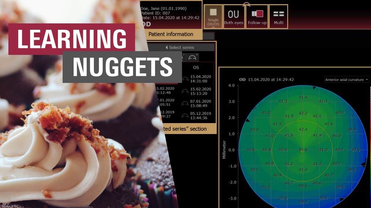 Navigating the Viewing Module Interface | ANTERION