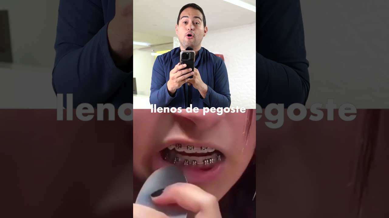 SE QUITA LOS BRACKETS CON UNA CUCHARA 🤦