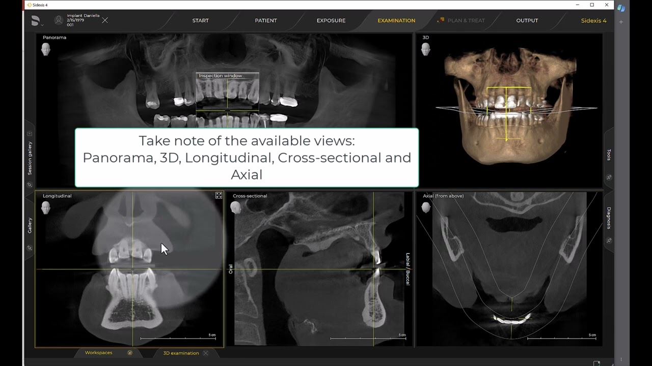Imaging Training Session 18:  Sidexis 4 - 3D Examination Basics