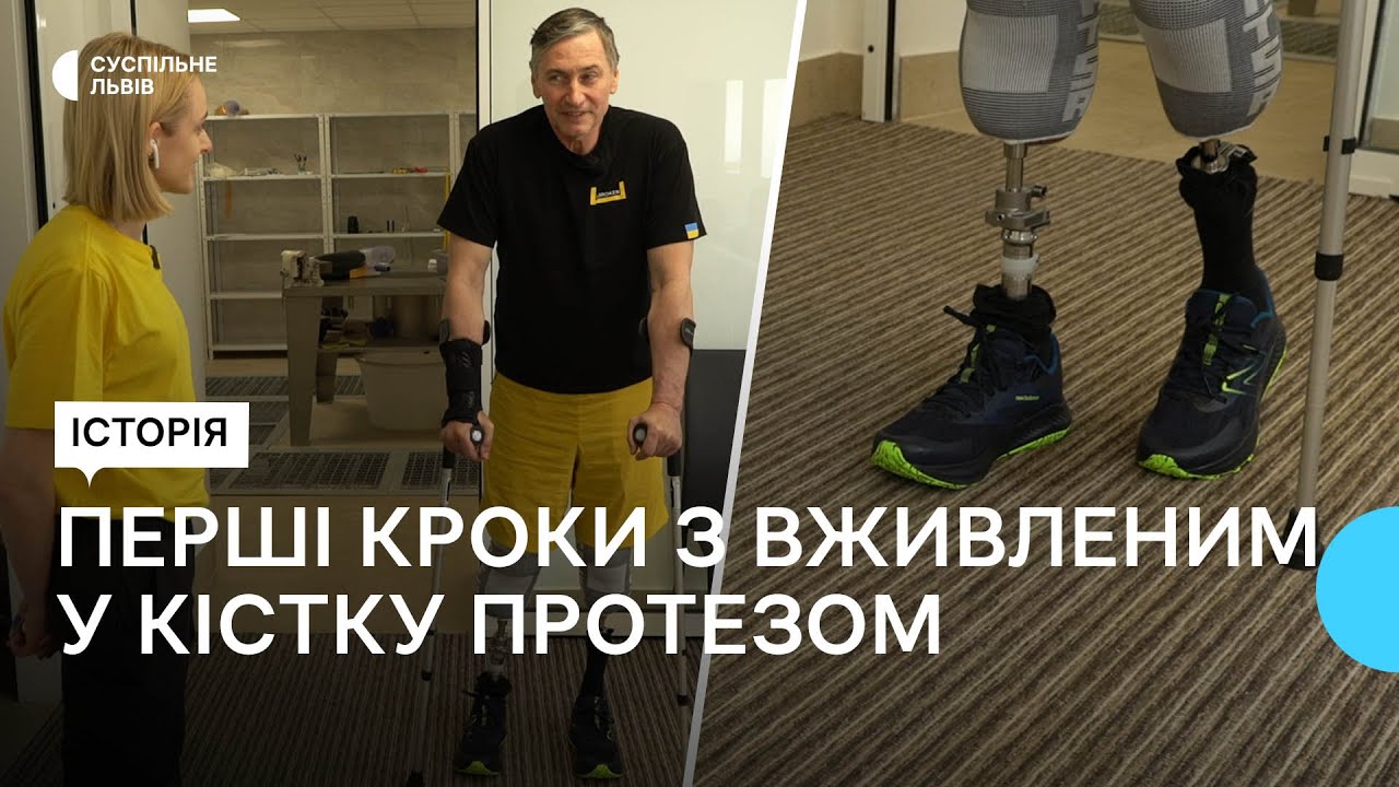 Перший в історії України пацієнт із вживленим у кістку протезом – ходить