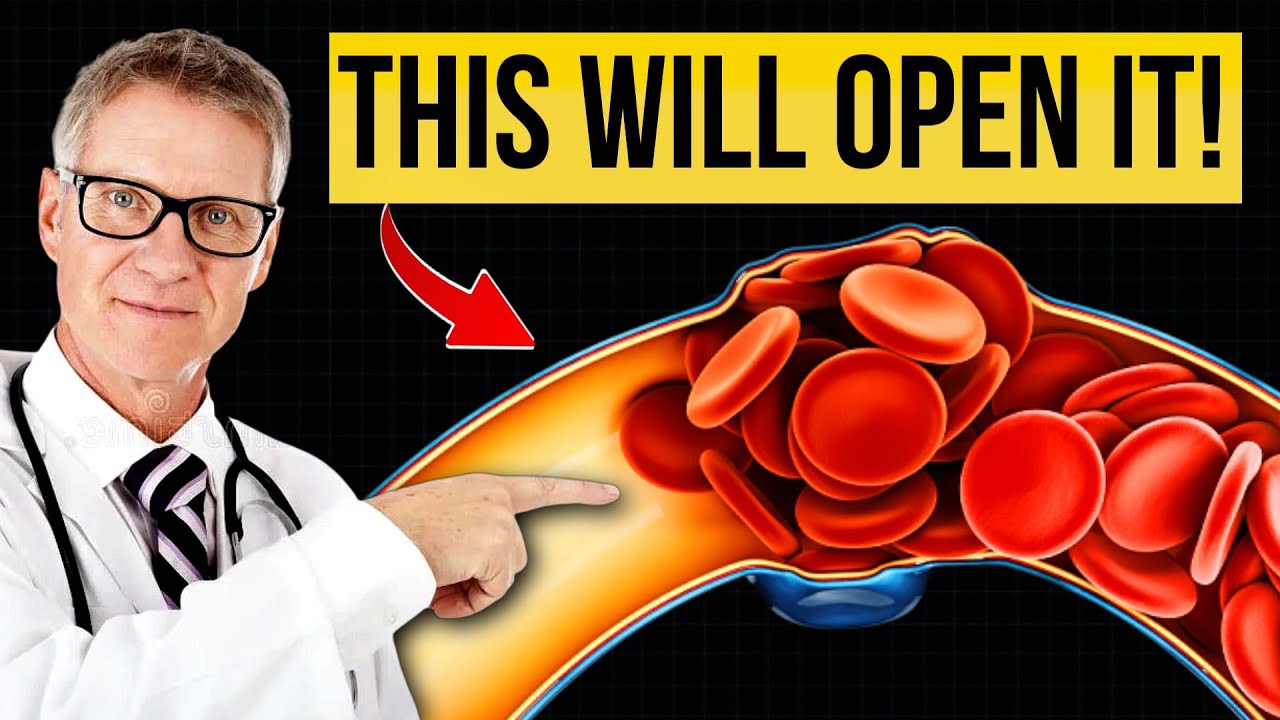 Best Meal to UNCLOG Your Arteries (Proven by Science)