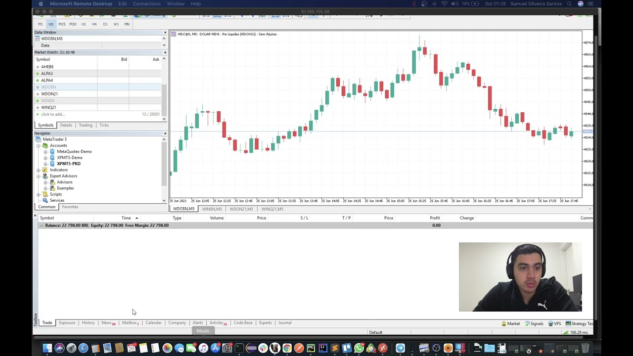 Gest&atilde;o de Capital dos Setups