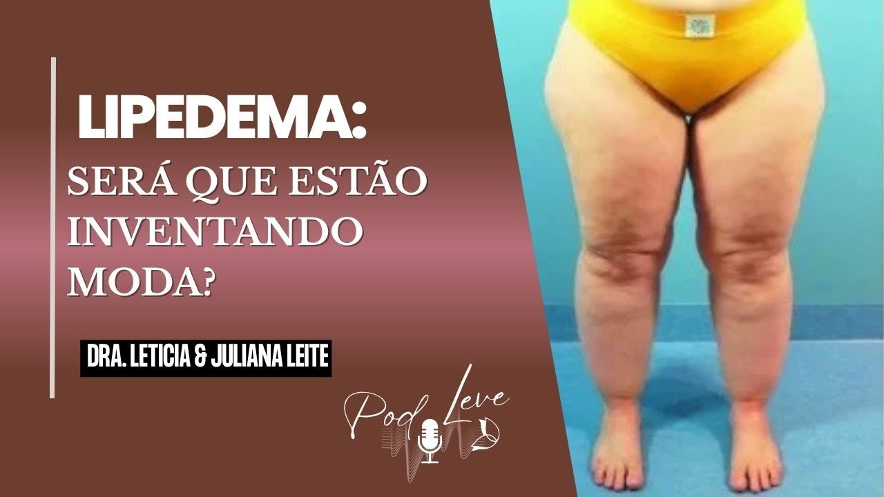 LIPEDEMA: Será Que Estão Inventando Moda? Descubra os SINAIS que Você Não Pode Ignorar!