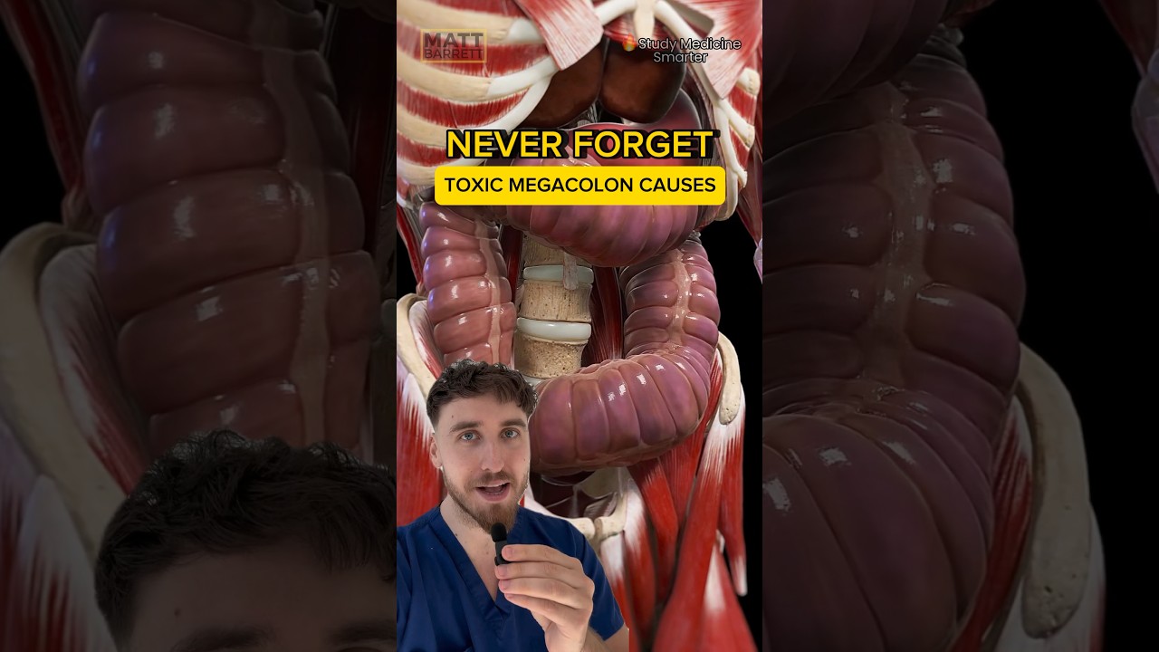 Remember MORE toxic megacolon causes!