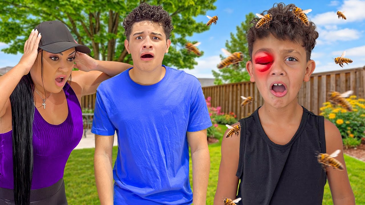 HE GOT STUNG BY A BEE...