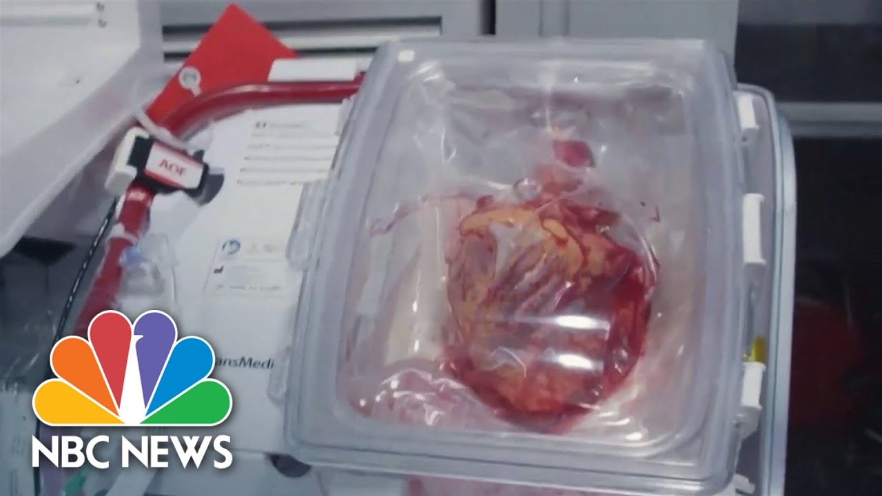 How 'heart in a box' technology could help heart transplant recipients&nbsp;