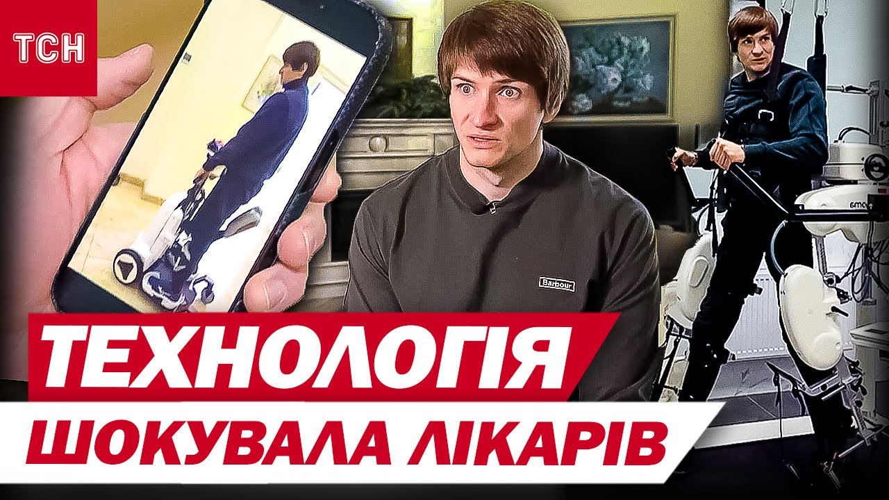 ПРОРИВ У МЕДИЦИНІ! У бійців з ПОШКОДЖЕНИМ КІСТКОВИМ МОЗКОМ з’явилась надія СТАТИ НА НОГИ!