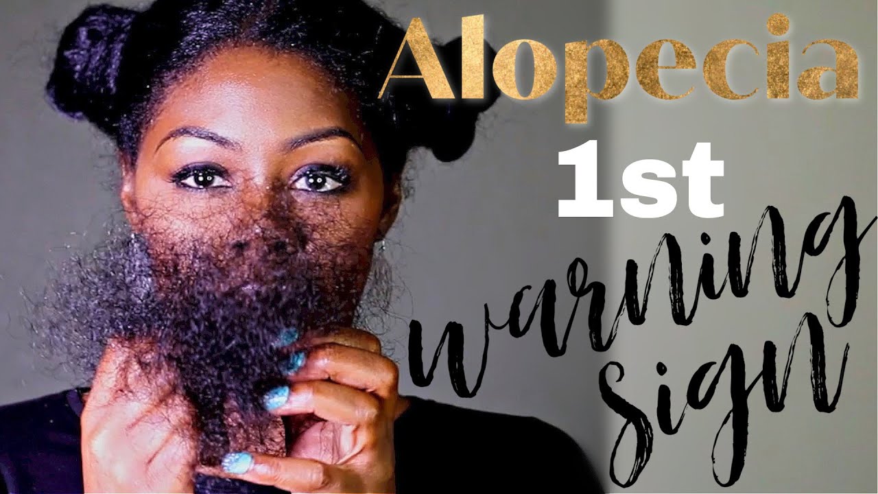 Alopecia: FIRST warning sign. What to look for.