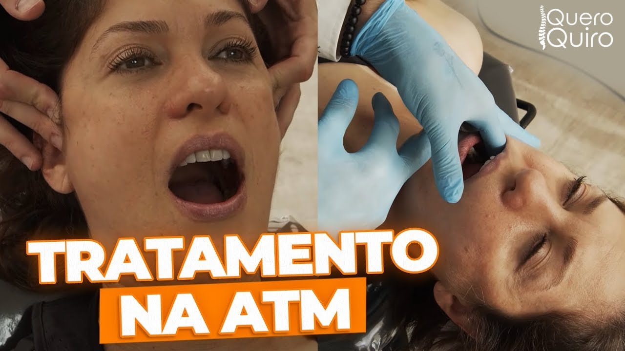 Tratamento para o BRUXISMO com ajustes de QUIROPRAXIA (ajustes na ATM)