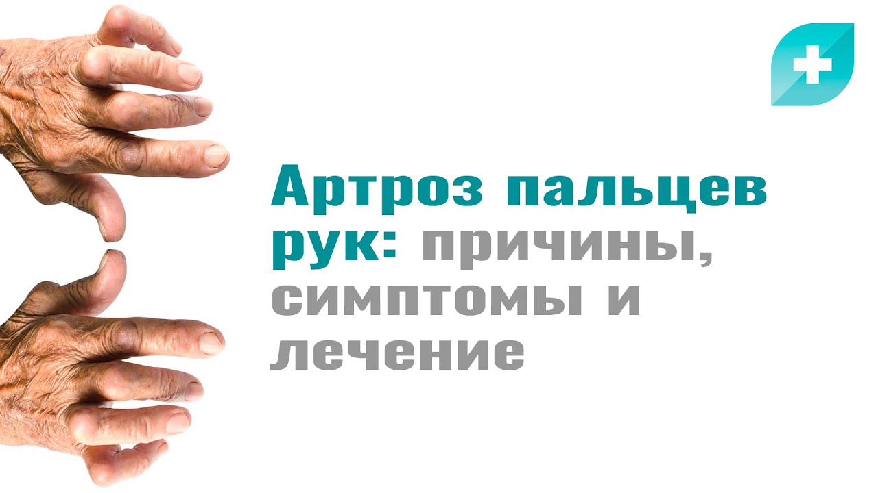 Артроз пальцев рук: причины,симптомы и лечение