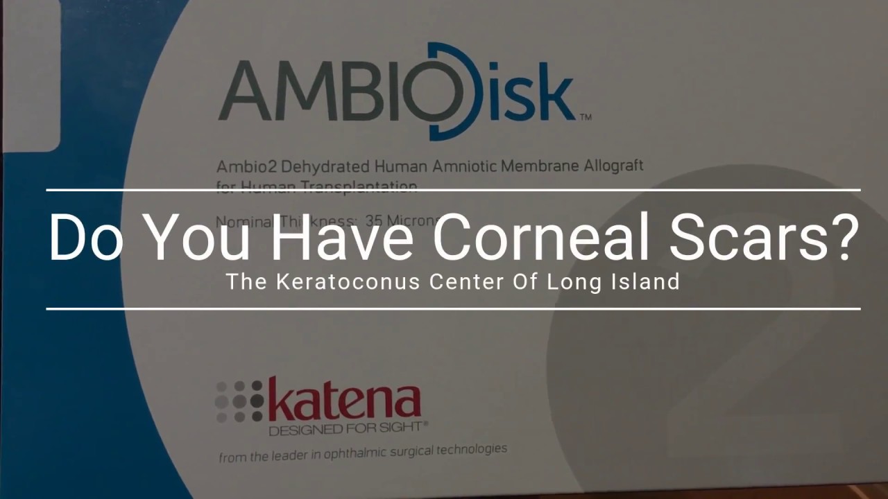 The Daily Tip:  Corneal Scar Treatment with Amniotic Membranes