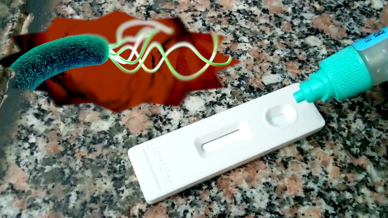 تحليل جرثومة المعدة في البراز عملي h.pylori Ag in stool