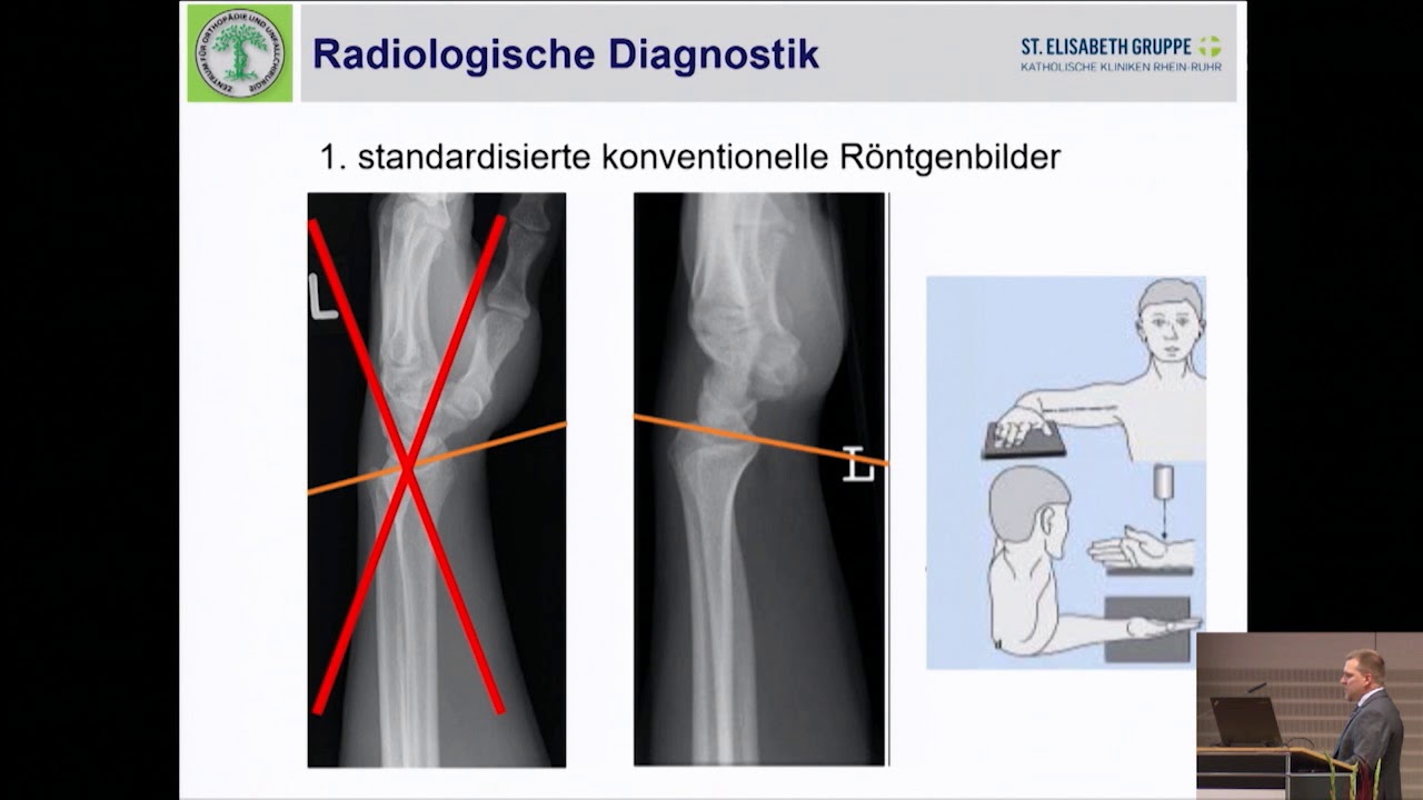 10/11 - Behandlungsalgorithmus der distalen Radiusfraktur